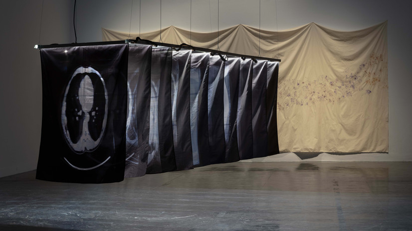 Dette kunstverket består av flere elementer: 
 LED Lys, aliminium componenter og røntgenskanninger av kunstnerens kropp tolket gjennom en defekt skjerm, dokumentert med kamera og printet på tekstil. 
Textilene er belyst ovenfra og henger vannrett og lagvis etter hverandre.