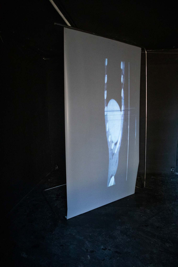 To skulpturer i metall; den ene fungerer som en projektor, mens den andre mottar og viser projiserte bilder.
videon er en 55-minutters loop med 4886 røntgenbilder av kunstnerens egen kropp.